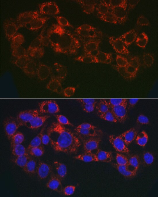 GPI-PLD/GPLD1 Antibody - Azide and BSA Free