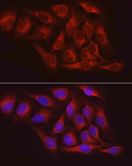 PTP1B/PTPN1 Antibody - Azide and BSA Free