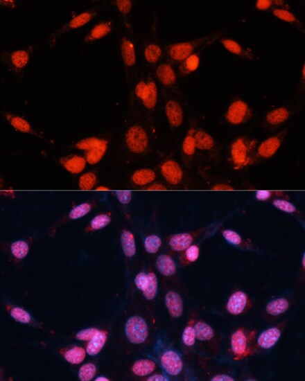 FUS Antibody - BSA Free