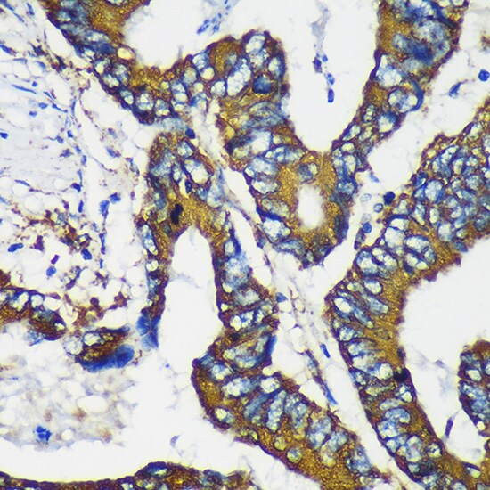 MKK4/MEK4 Antibody - BSA Free