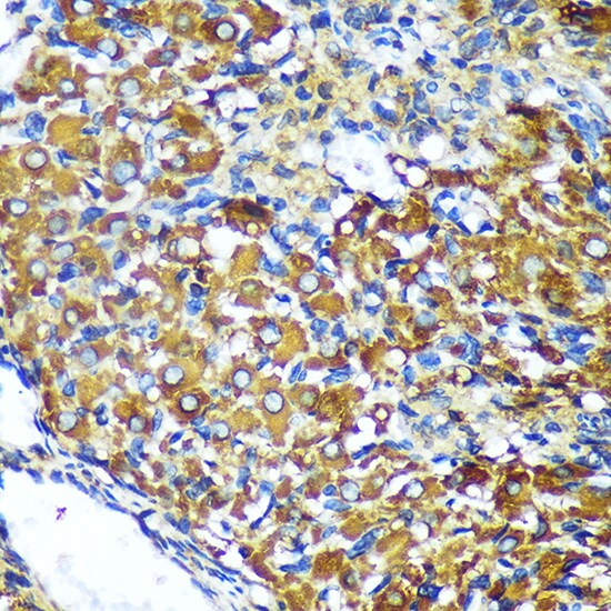 MKK4/MEK4 Antibody - BSA Free