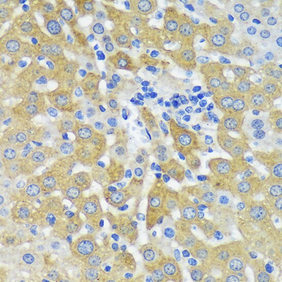 MKK4/MEK4 Antibody - BSA Free