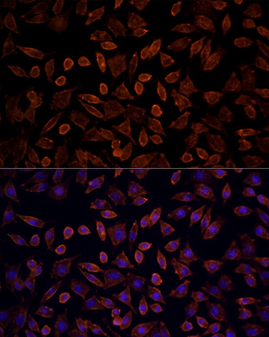 KRAS Antibody - Azide and BSA Free
