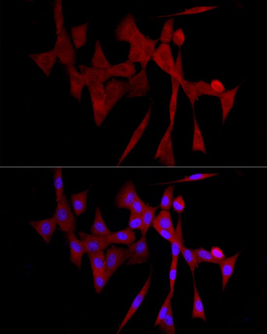 GLT25D1 Antibody - Azide and BSA Free