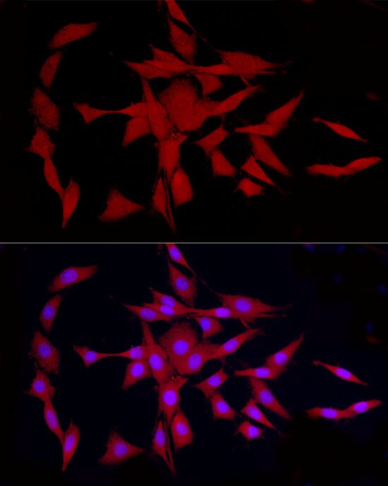 GLT25D1 Antibody - Azide and BSA Free