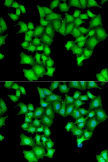 INTS11 Antibody - BSA Free
