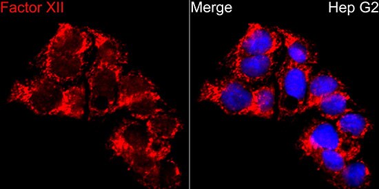 Factor XII Antibody - BSA Free