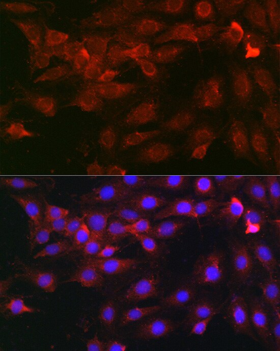Heparanase/HPSE Antibody - Azide and BSA Free