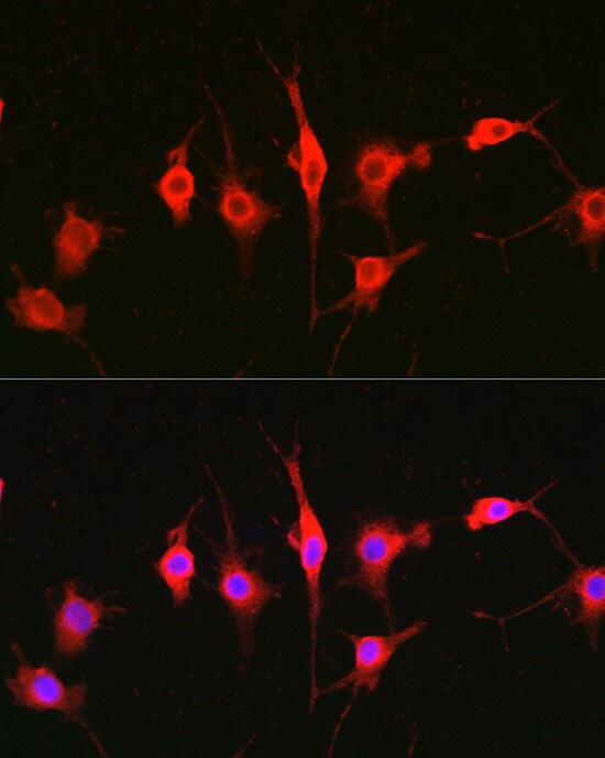 Heparanase/HPSE Antibody - Azide and BSA Free