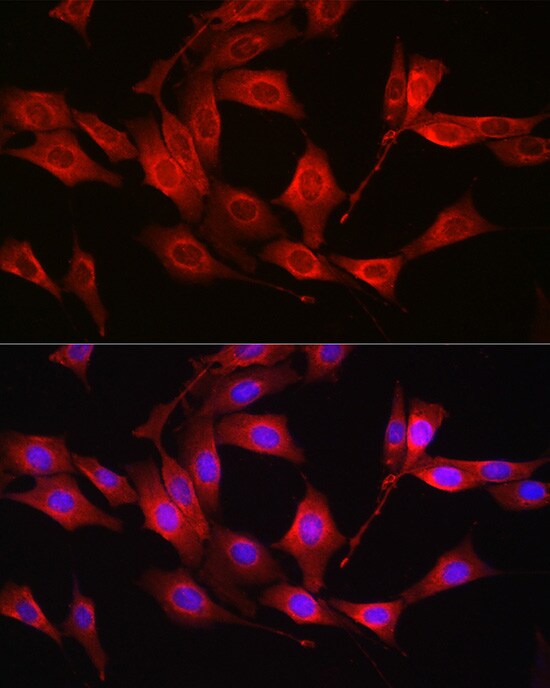 Glutathione Synthetase Antibody - Azide and BSA Free