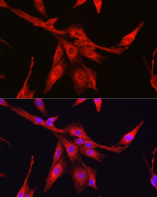 Glutathione Synthetase Antibody - Azide and BSA Free