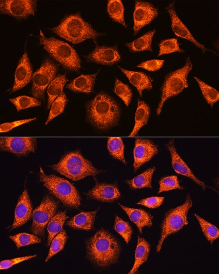 GADD34 Antibody - Azide and BSA Free