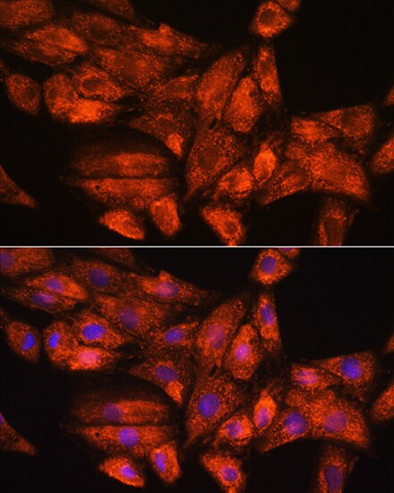 GADD34 Antibody - Azide and BSA Free