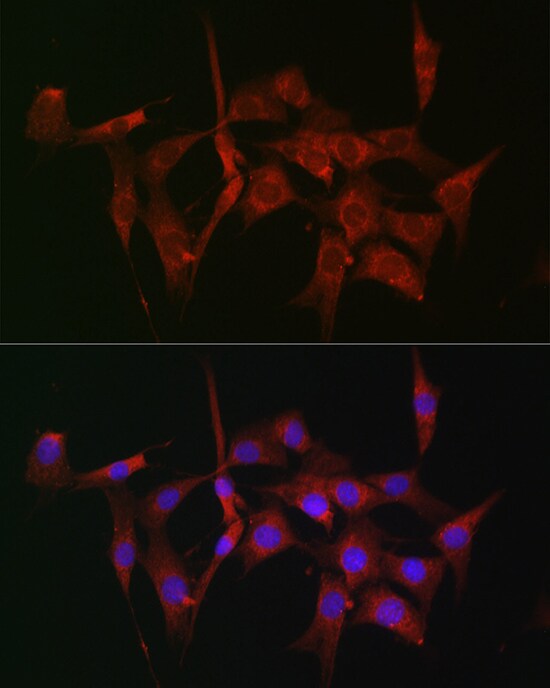 Fascin Antibody - BSA Free