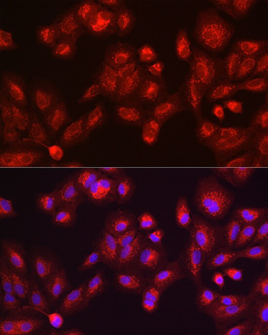 Galactosylceramidase/GALC Antibody - BSA Free