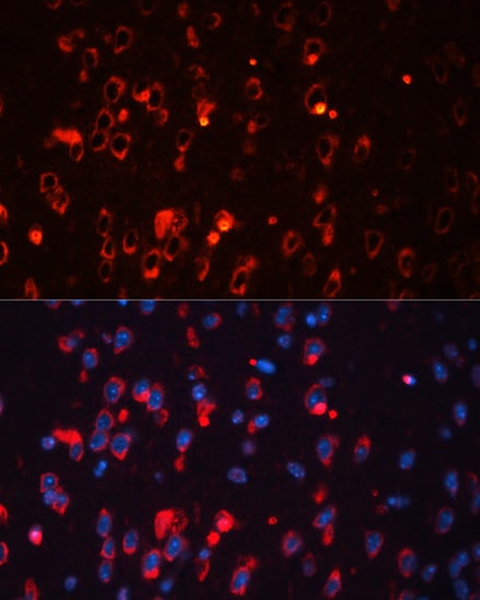 Kv1.1 Antibody - Azide and BSA Free