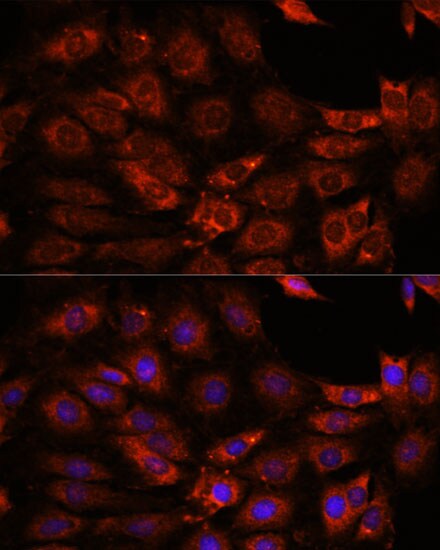 GIT1 Antibody - Azide and BSA Free
