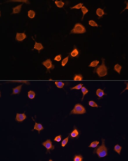 NF2/Merlin Antibody - BSA Free