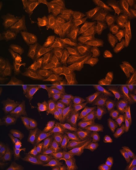 NF2/Merlin Antibody - BSA Free