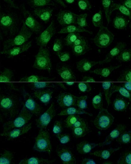 hnRNP M Antibody - Azide and BSA Free
