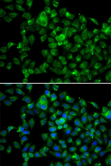 CML2 Antibody - BSA Free