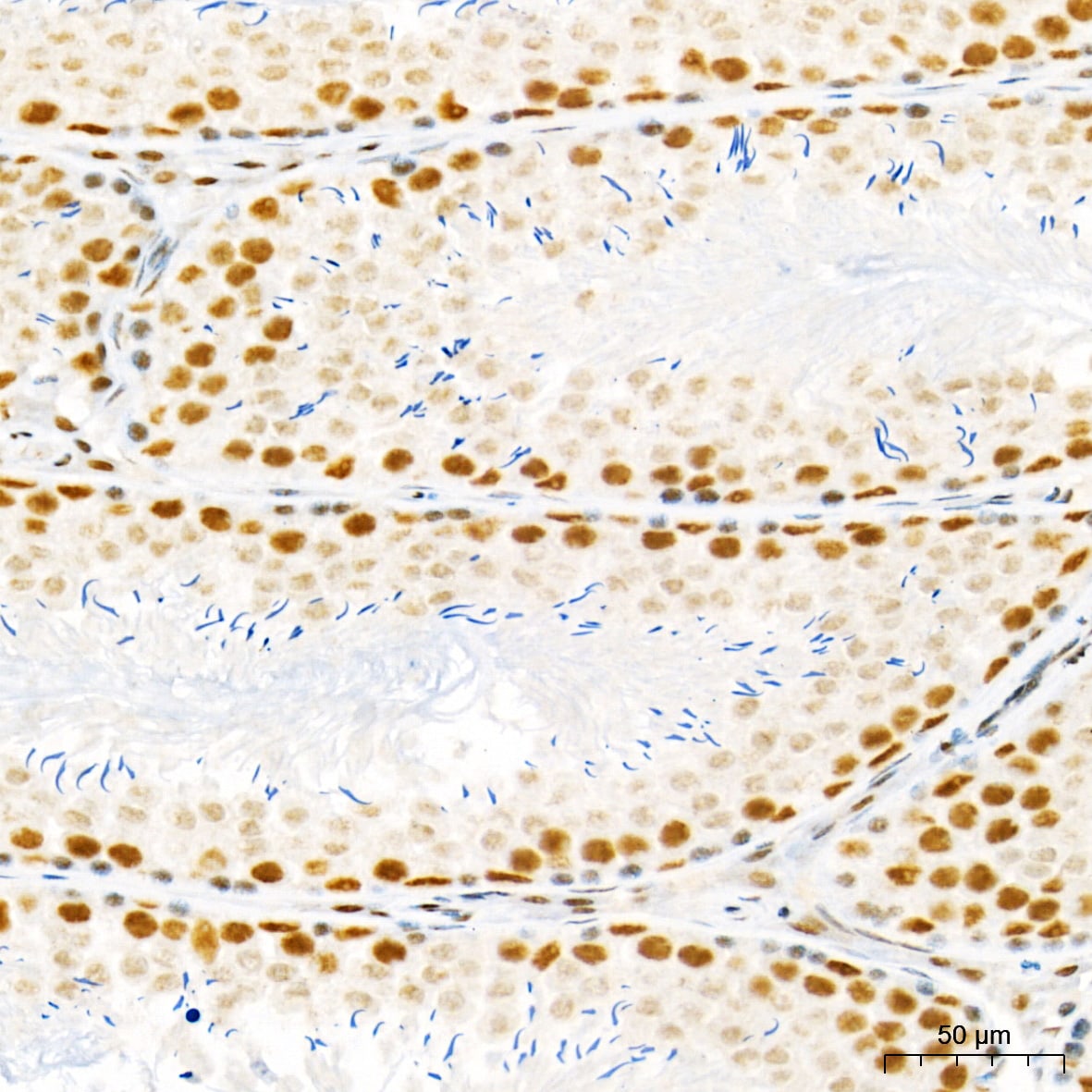HYPB Antibody - Azide and BSA Free