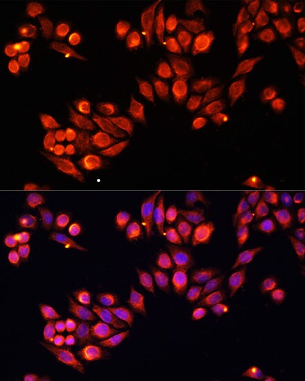 Heparanase/HPSE Antibody - Azide and BSA Free
