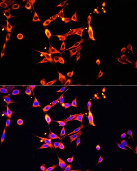 Heparanase/HPSE Antibody - Azide and BSA Free