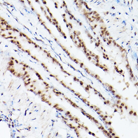 PA28 Activator gamma Subunit/PSME3 Antibody - Azide and BSA Free
