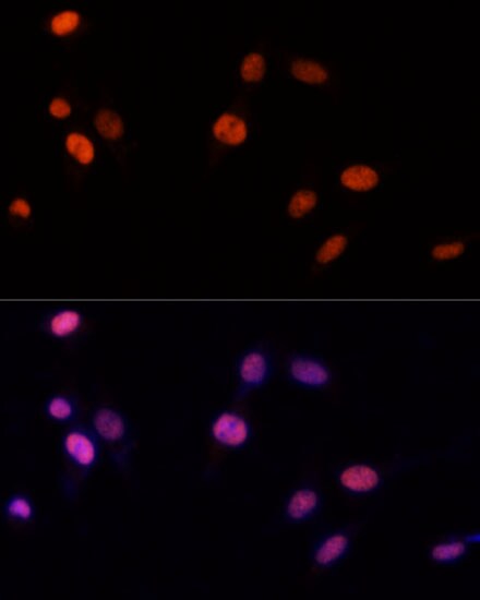 PA28 Activator gamma Subunit/PSME3 Antibody - Azide and BSA Free