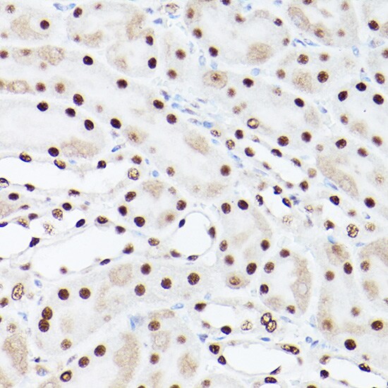 PA28 Activator gamma Subunit/PSME3 Antibody - Azide and BSA Free