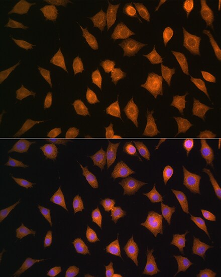 ELOVL4 Antibody - Azide and BSA Free