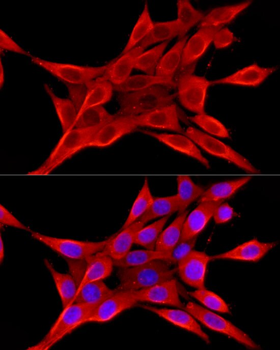 ELOVL4 Antibody - Azide and BSA Free