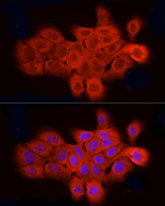 ELOVL4 Antibody - Azide and BSA Free