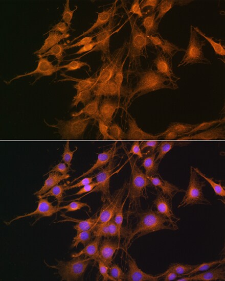 ELOVL4 Antibody - Azide and BSA Free