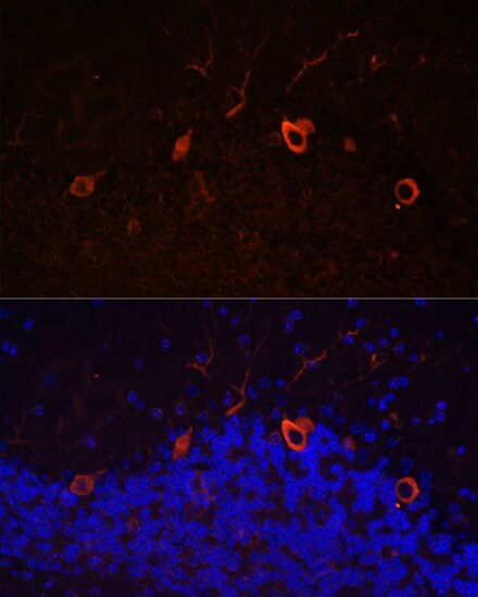 KAL1 Antibody - Azide and BSA Free