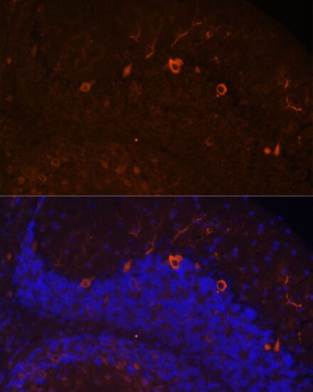 KAL1 Antibody - Azide and BSA Free