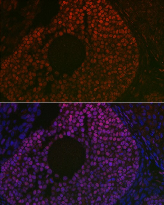 FOXL2 Antibody - Azide and BSA Free