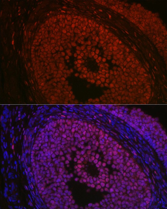 FOXL2 Antibody - Azide and BSA Free