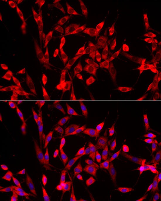 USP21 Antibody - Azide and BSA Free