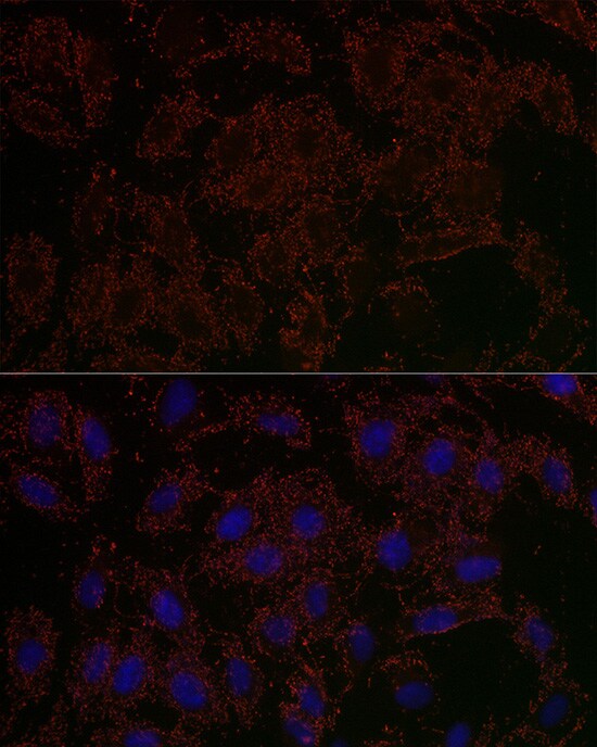 GLS2 Antibody - Azide and BSA Free