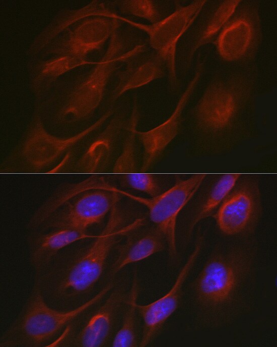 TRAF7 Antibody - Azide and BSA Free