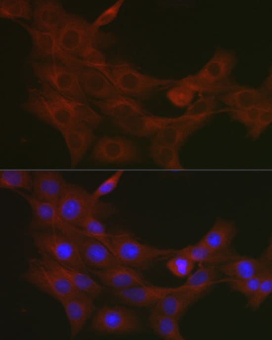 TRAF7 Antibody - Azide and BSA Free