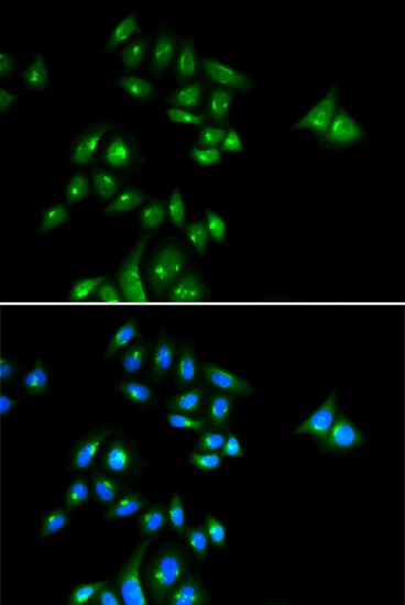 PHC3 Antibody - BSA Free
