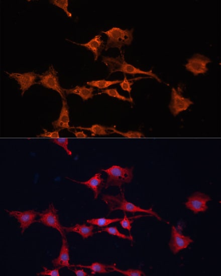 GSTM3 Antibody - Azide and BSA Free