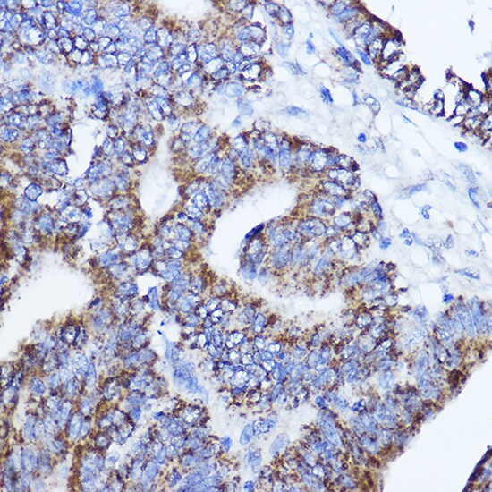 LRPPRC Antibody - BSA Free