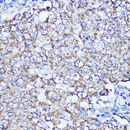 LRPPRC Antibody - BSA Free