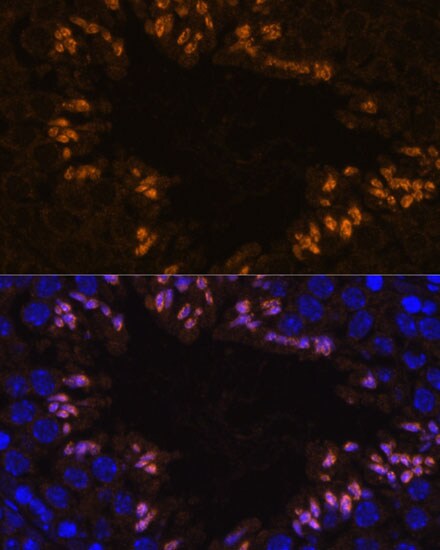 ELSPBP1 Antibody - Azide and BSA Free
