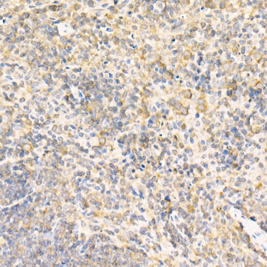 RPLP2 Antibody - BSA Free