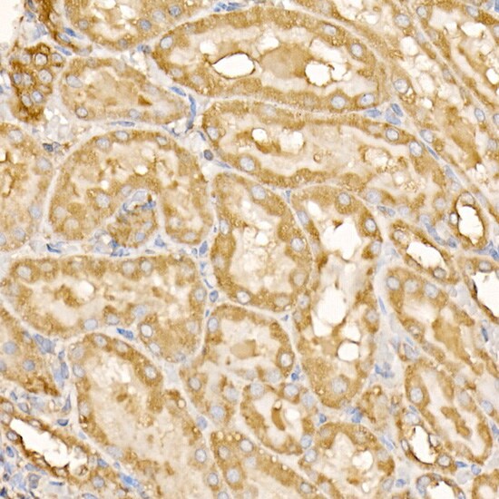 RPLP2 Antibody - BSA Free